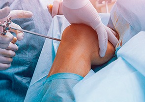 artroscopia no joelho CEO Centro de Ortopedia CEO Centro de Ortopedia